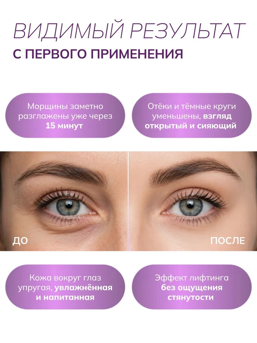 VonU Антивозрастные патчи Age Reverse