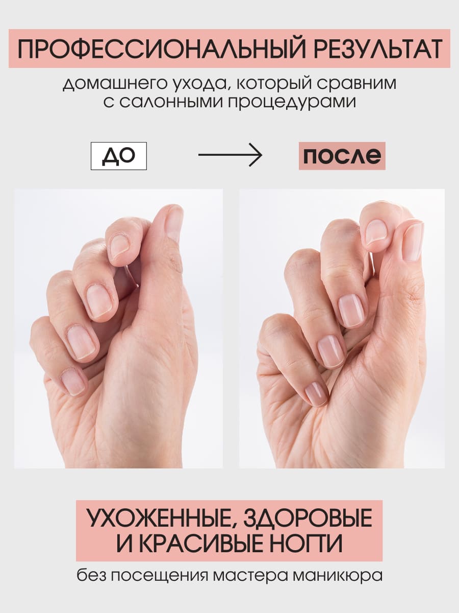 BERENICE Golden harmony set Набор для восстановления и укрепления ногтей (Cuticle peeling 15 ml, Time reverse 15 ml, Miracle Gold Elixir 15 ml)